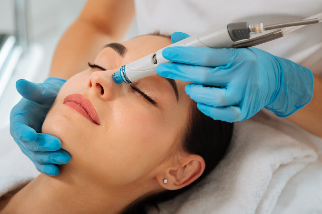 hydrafacial for hyperpigmentation