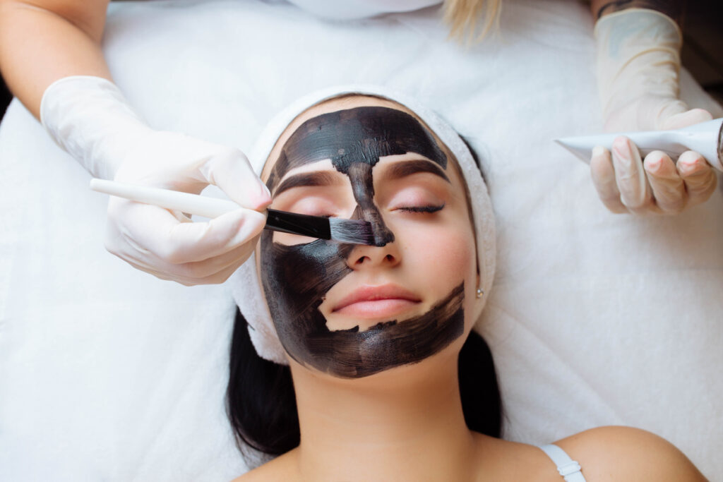 carbon laser peel for acne scars